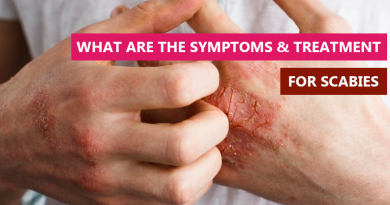 What are the Symptoms & Treatment for Scabies