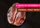 6 signs of suffering from vaginal yeast infection