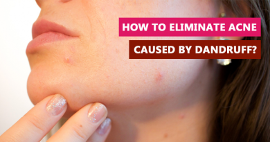 How to eliminate acne caused by dandruff