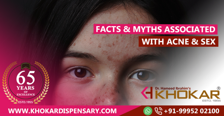 Facts And Myths Associated With Acne And Sex Health Tips 7674