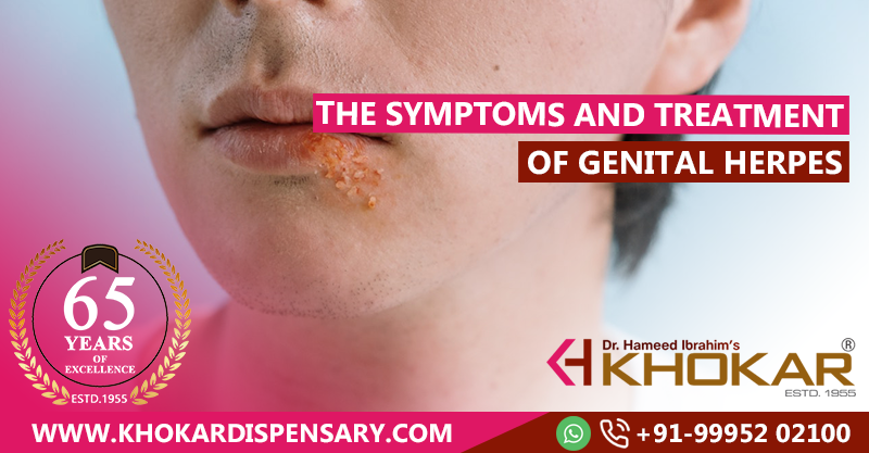 The Symptoms And Treatment Of Genital Herpes Health Tips