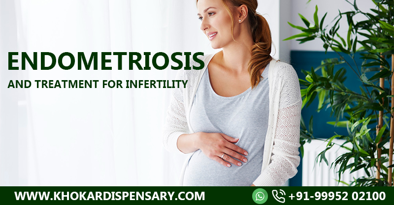 Endometriosis and Treatment for Infertility