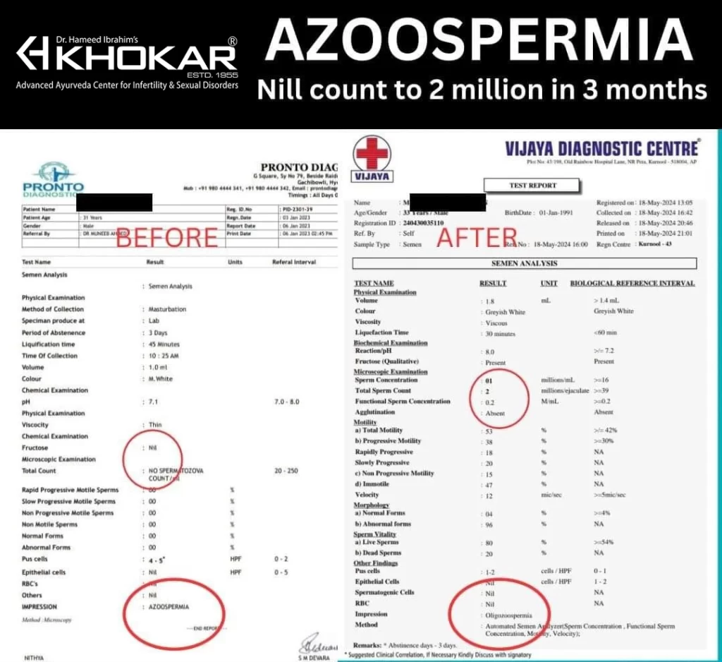 khokar sperm count testmonial