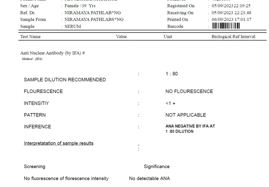 ANA Negative report after treatment