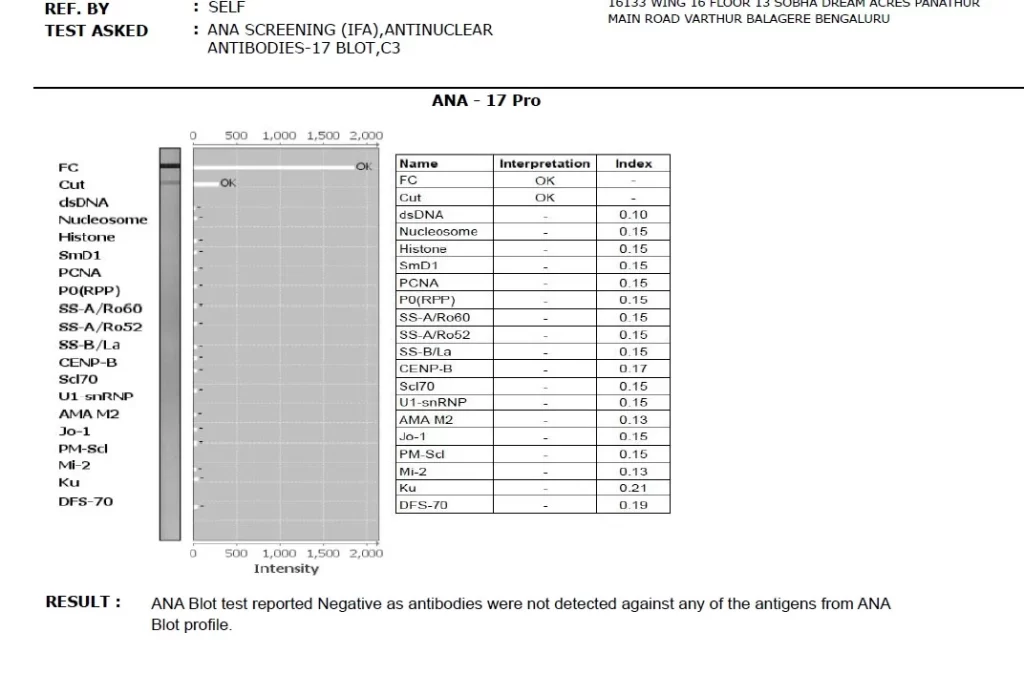 ANA Negative report after treatment Reconfirmed by another Laboratory